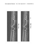 SEGMENTATION AND IDENTIFICATION OF LAYERED STRUCTURES IN IMAGES diagram and image