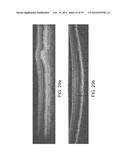 SEGMENTATION AND IDENTIFICATION OF LAYERED STRUCTURES IN IMAGES diagram and image