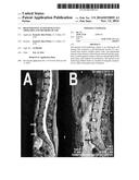 REGENERATIVE AUTOLOGOUS CELL THERAPIES AND METHODS OF USE diagram and image