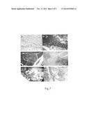 LACTOBACILLUS PLANTARUM INDUCIA DSM 21379 AS ENHANCER OF CELLULAR     IMMUNITY, HYPOCHOLESTEROLEMIC AND ANTI-OXIDATIVE AGENT AND ANTIMICROBIAL     AGENT AGAINST CLOSTRIDIUM DIFFICILE diagram and image