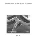 Polymer Blends For Drug Delivery Stent Matrix With Improved Thermal     Stability diagram and image