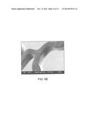 Polymer Blends For Drug Delivery Stent Matrix With Improved Thermal     Stability diagram and image