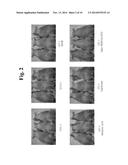 COMPOSITION FOR IMPROVING SKIN CONDITIONS, CONTAINING EXTRACELLULAR DOMAIN     OF HUMAN BONE MORPHOGENETIC PROTEIN RECEPTOR 1a AS ACTIVE INGREDIENT diagram and image