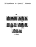 COMPOSITION FOR IMPROVING SKIN CONDITIONS, CONTAINING EXTRACELLULAR DOMAIN     OF HUMAN BONE MORPHOGENETIC PROTEIN RECEPTOR 1a AS ACTIVE INGREDIENT diagram and image