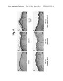 COMPOSITION FOR IMPROVING SKIN CONDITIONS, CONTAINING EXTRACELLULAR DOMAIN     OF HUMAN BONE MORPHOGENETIC PROTEIN RECEPTOR 1a AS ACTIVE INGREDIENT diagram and image