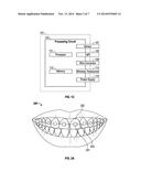 ORAL ILLUMINATION SYSTEMS AND METHODS diagram and image