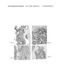 Porous Three-Dimensional Structure of Polytetrafluoroethylene (Versions),     Dental Implant, Vascular Implant and Tissue Implant for Substitution     Plasty of Soft Tissues diagram and image