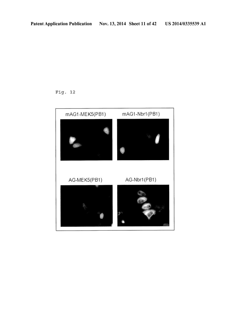 METHOD FOR DETECTING PROTEIN-PROTEIN INTERACTION - diagram, schematic, and image 12