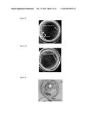 HUMAN PLURIPOTENT STEM CELLS PRODUCED BY SOMATIC CELL NUCLEAR TRANSFER diagram and image