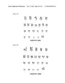 HUMAN PLURIPOTENT STEM CELLS PRODUCED BY SOMATIC CELL NUCLEAR TRANSFER diagram and image