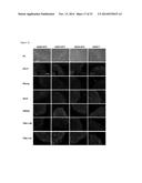 HUMAN PLURIPOTENT STEM CELLS PRODUCED BY SOMATIC CELL NUCLEAR TRANSFER diagram and image