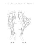 TONING GARMENT WITH INTEGRATED DAMPER diagram and image