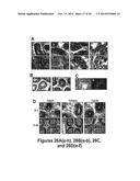 DRG11-RESPONSIVE (DRAGON) GENE AND USES THEREOF diagram and image