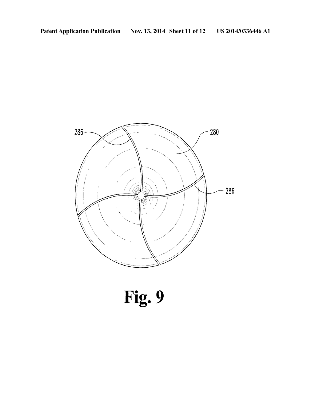 CAVOPULMONARY VISCOUS IMPELLER ASSIST DEVICE AND METHOD - diagram, schematic, and image 12