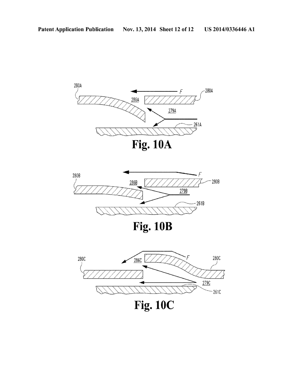 CAVOPULMONARY VISCOUS IMPELLER ASSIST DEVICE AND METHOD - diagram, schematic, and image 13