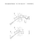 SYSTEMS AND METHODS EMPLOYING A PUSH TUBE FOR DELIVERING A URETHRAL SLING diagram and image