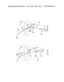 SYSTEMS AND METHODS EMPLOYING A PUSH TUBE FOR DELIVERING A URETHRAL SLING diagram and image