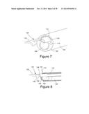 METHOD AND APPARATUS FOR STEERABLE, ROTATABLE, MICROENDOSCOPE WITH TOOL     FOR CUTTING, COAGULATING, DESICCATING AND FULGURATING TISSUE diagram and image