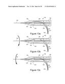 METHOD AND APPARATUS FOR STEERABLE, ROTATABLE, MICROENDOSCOPE WITH TOOL     FOR CUTTING, COAGULATING, DESICCATING AND FULGURATING TISSUE diagram and image