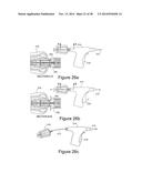 METHOD AND APPARATUS FOR STEERABLE, ROTATABLE, MICROENDOSCOPE WITH TOOL     FOR CUTTING, COAGULATING, DESICCATING AND FULGURATING TISSUE diagram and image