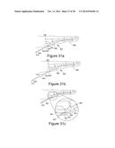 METHOD AND APPARATUS FOR STEERABLE, ROTATABLE, MICROENDOSCOPE WITH TOOL     FOR CUTTING, COAGULATING, DESICCATING AND FULGURATING TISSUE diagram and image