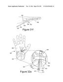 METHOD AND APPARATUS FOR STEERABLE, ROTATABLE, MICROENDOSCOPE WITH TOOL     FOR CUTTING, COAGULATING, DESICCATING AND FULGURATING TISSUE diagram and image