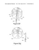 METHOD AND APPARATUS FOR STEERABLE, ROTATABLE, MICROENDOSCOPE WITH TOOL     FOR CUTTING, COAGULATING, DESICCATING AND FULGURATING TISSUE diagram and image