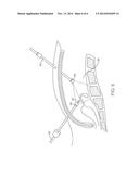 ENDOSCOPE ASSEMBLY WITH A POLARIZING FILTER diagram and image