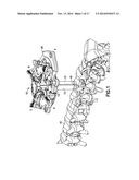 KIT OF PARTS FOR USE IN RETRACTING BODY TISSUE diagram and image