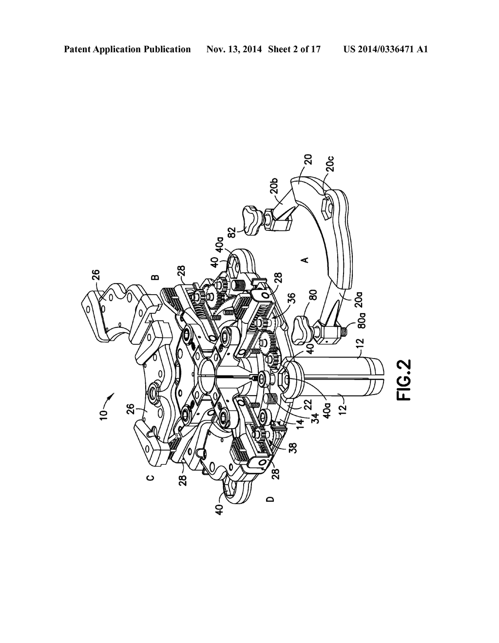 KIT OF PARTS FOR USE IN RETRACTING BODY TISSUE - diagram, schematic, and image 03