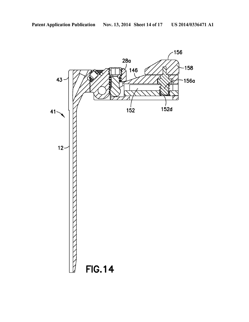 KIT OF PARTS FOR USE IN RETRACTING BODY TISSUE - diagram, schematic, and image 15