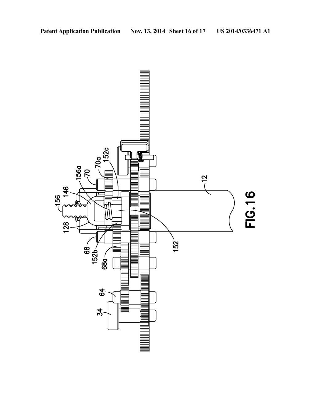 KIT OF PARTS FOR USE IN RETRACTING BODY TISSUE - diagram, schematic, and image 17