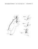 APPARATUS FOR MONITORING ARTERIAL PULSE WAVES IN DIAGNOSING VARIOUS     MEDICAL CONDITIONS diagram and image