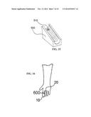 APPARATUS FOR MONITORING ARTERIAL PULSE WAVES IN DIAGNOSING VARIOUS     MEDICAL CONDITIONS diagram and image