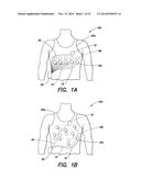 WEARABLE AMBULATORY MEDICAL DEVICE WITH MULTIPLE SENSING ELECTRODES diagram and image