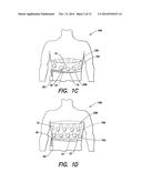 WEARABLE AMBULATORY MEDICAL DEVICE WITH MULTIPLE SENSING ELECTRODES diagram and image