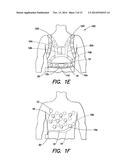 WEARABLE AMBULATORY MEDICAL DEVICE WITH MULTIPLE SENSING ELECTRODES diagram and image