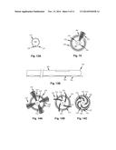 SAMPLING CATHETER DEVICES, METHODS, AND SYSTEMS diagram and image