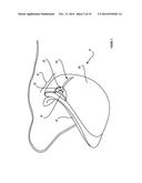 Personal Care Vaporizer Device for the Eye Area of the Face diagram and image