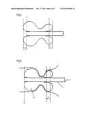 DEVICE FOR THE TRANS-ANAL DRAINAGE OF STOOL FROM THE RECTUM OF A PATIENT     AND/OR FOR THE TRANS-ANAL APPLICATION OF INFLOWING LIQUID THROUGH A     CATHETER-LIKE ELEMENT diagram and image