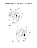 System, Method, and Kit for Providing the Diameter of a Balloon During     Treatment diagram and image