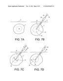 ABLATION PROBE WITH FLARED ELECTRODES diagram and image