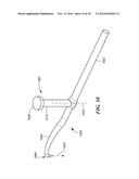 MICROFRACTURE PICK diagram and image