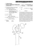 POSITIONING APPARATUS AND METHOD FOR A PROSTHETIC IMPLANT diagram and image