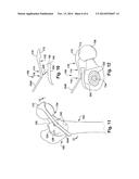 POSITIONING APPARATUS AND METHOD FOR A PROSTHETIC IMPLANT diagram and image