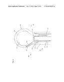 TISSUE LIGATION DEVICES AND METHODS THEREFOR diagram and image