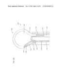 TISSUE LIGATION DEVICES AND METHODS THEREFOR diagram and image