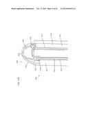 TISSUE LIGATION DEVICES AND METHODS THEREFOR diagram and image