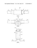 METHODS AND DEVICES FOR CONNECTING NERVES diagram and image