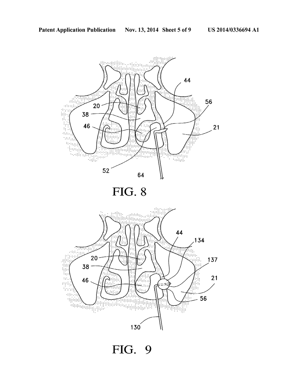 BALLOON CATHETERS AND METHODS FOR TREATING PARANASAL SINUSES - diagram, schematic, and image 06